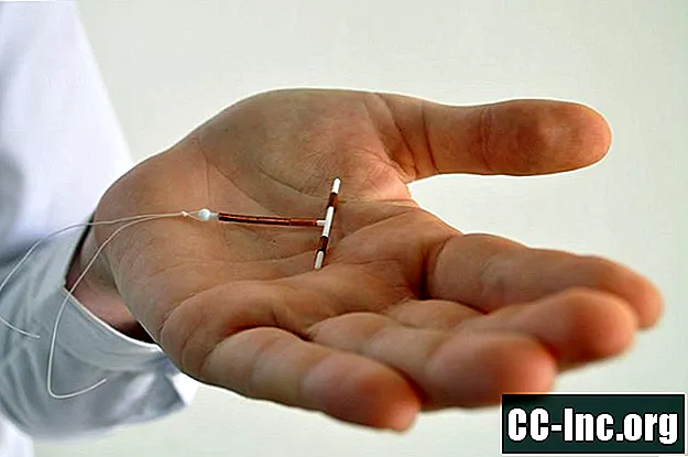 IUD-användning hos nollipara kvinnor