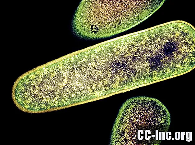 Infecção difícil por Clostridium com doença inflamatória intestinal