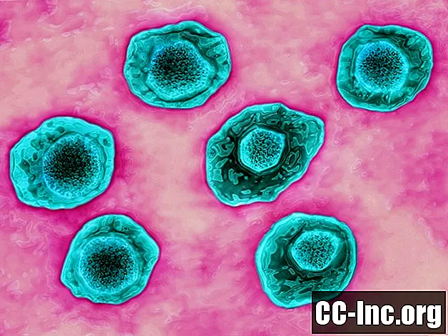 Je virus Epstein-Barr povezan z avtoimunsko boleznijo?