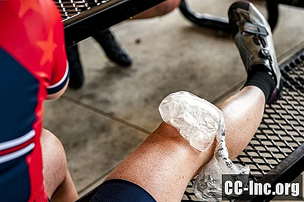 怪我の治療には氷か熱が良いですか？