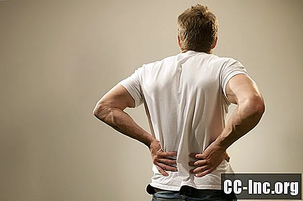 Đau lưng của bạn là không cụ thể, cơ học hay nghiêm trọng?