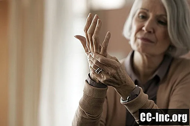 Articulações mais afetadas pela artrite reumatóide