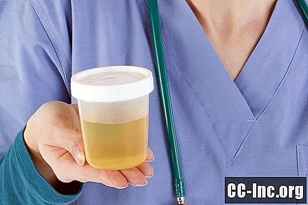 Problemas renais e do trato urinário após a cirurgia - Medicamento