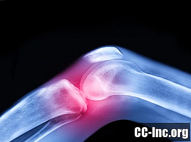 Liječenje infekcije zgloba koljena