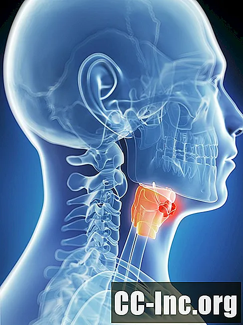 喉頭がんは早期に発見されれば非常に治療可能です