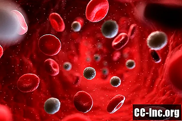 تعلم بالضبط ما يمكن أن تخبرك به مؤشرات خلايا الدم الحمراء
