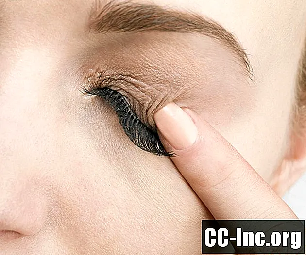 Tìm hiểu một số nguyên nhân phổ biến gây ngứa mi mắt