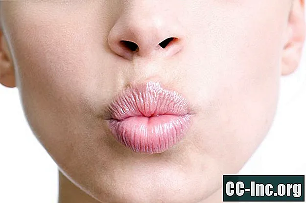 삼키는 능력을 회복하기위한 입술 운동