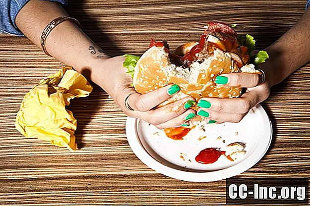 Przystawki Fast Food o niskiej zawartości cholesterolu