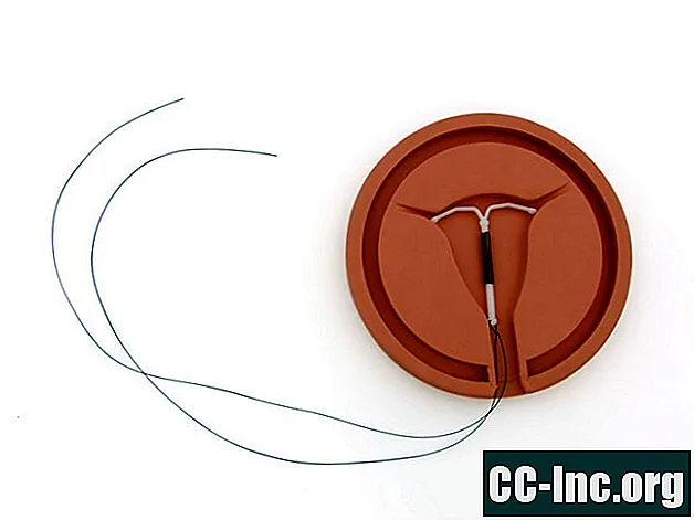 Cara Memeriksa String IUD Anda