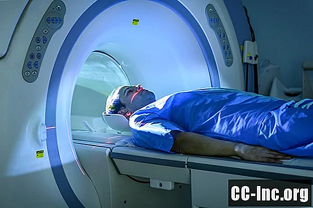 التصوير بالرنين المغناطيسي (MRI) للتصلب المتعدد
