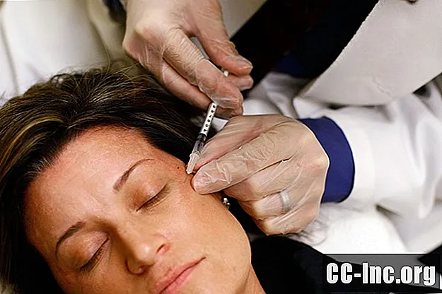 Tapaa Botox-vaihtoehtoja ajankohtaisista voiteista kirurgiaan