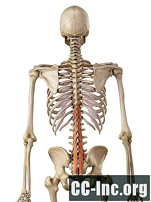 Skupine mišic globokega hrbta Multifidus in Rotatores - Zdravilo