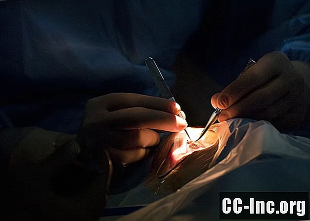 Lentile intraoculare multifocale pentru chirurgia cataractei