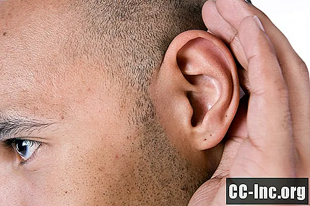 תסמונת האוזן המוסיקלית