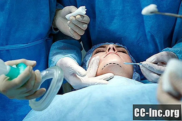 Oštećenje živaca nakon plastične kirurgije