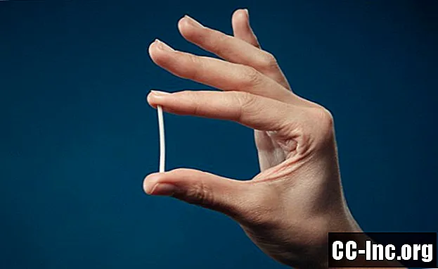 Nexplanon: vsadek za kontracepcijo z eno palico - Zdravilo