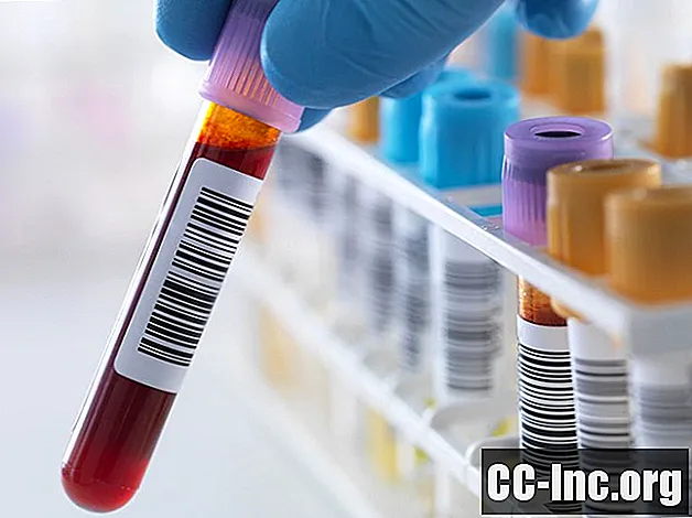 Ujian Pengukuhan Asid Nukleik untuk STD - Ubat