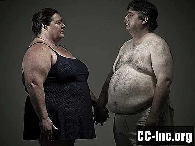 Obesiti dan Sakit Belakang Punggung