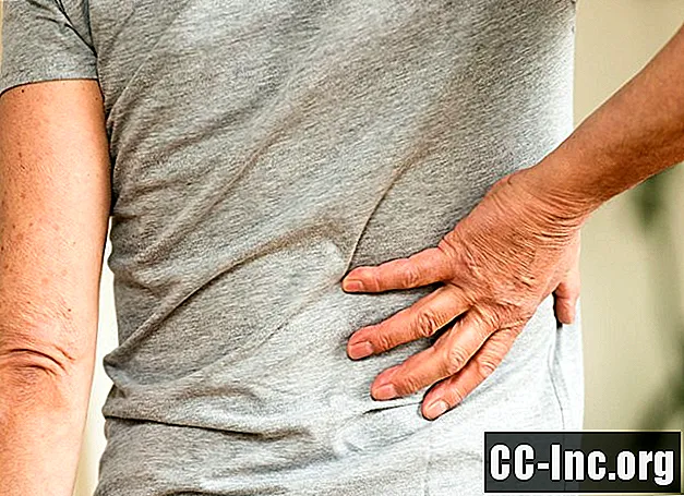 Descripción general del dolor de espalda causado por lumbago