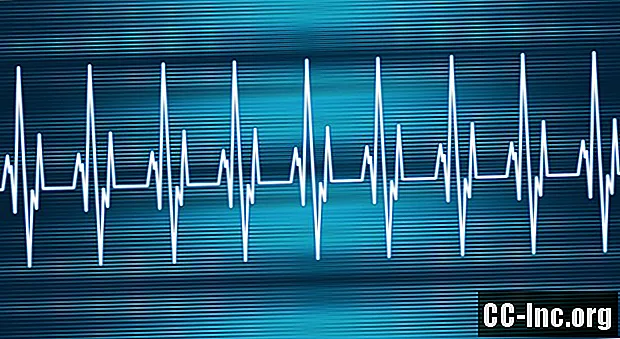 Огляд тахікардій і швидких серцевих ритмів
