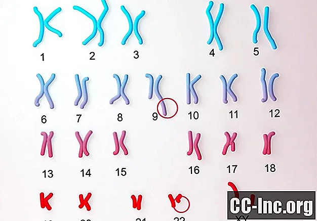 Filadelfijos chromosomos apžvalga