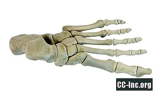 A lábon lévő tarzalis csontok áttekintése
