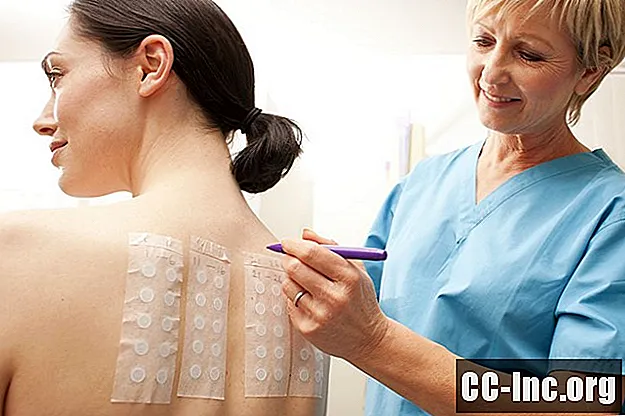 Test de patch pour diagnostiquer la dermatite de contact