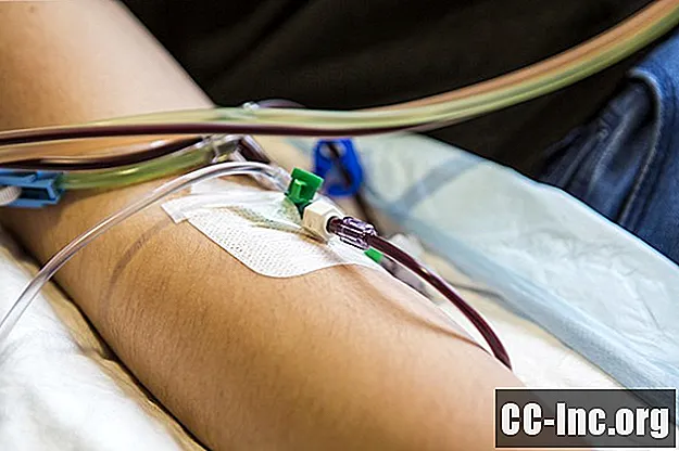 Riesgos de la donación de células madre de sangre periférica