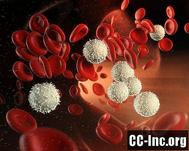 Presaditev matičnih celic periferne krvi (PBSCT)