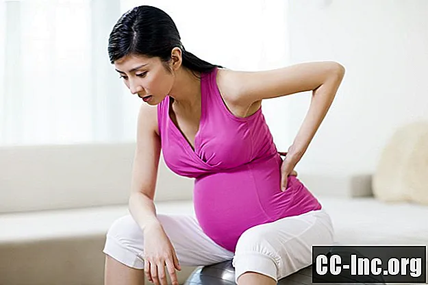 임신 중 허리 통증에 대한 물리 치료