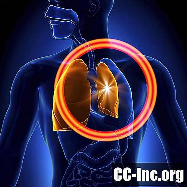 Viêm màng phổi: Định nghĩa, Quy trình và Chỉ định