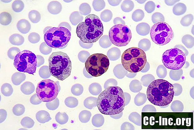 Polymorfonucleaire leukocyten Witte bloedcellen