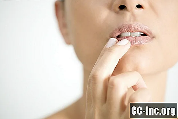 Causes possibles des lèvres enflées