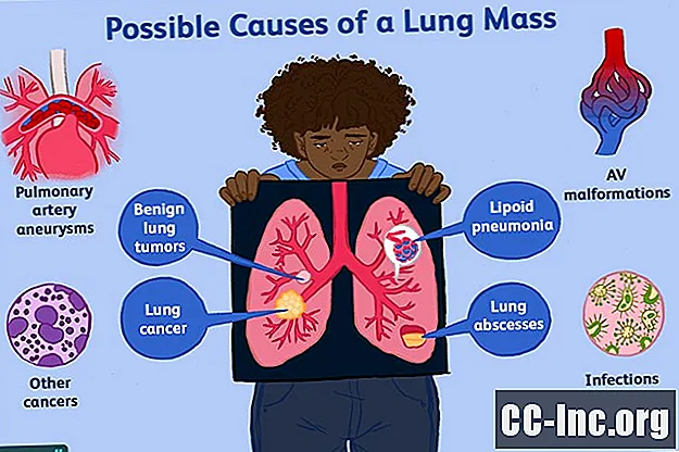 Causes possibles d'une masse pulmonaire