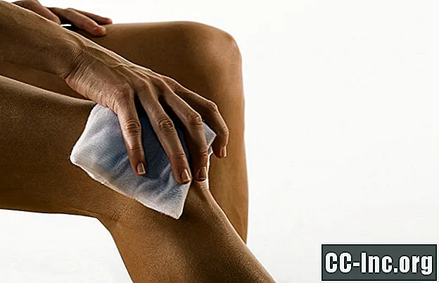 Симптоми и лечење препателарног бурзитиса зглоба колена - Лек