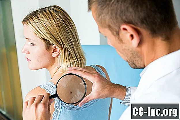 Pros y contras de la disección de ganglios linfáticos para el tratamiento del melanoma