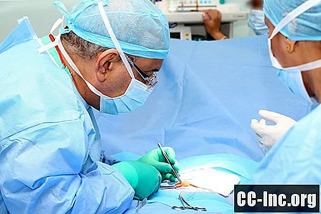 Propósito de la cirugía de hernia