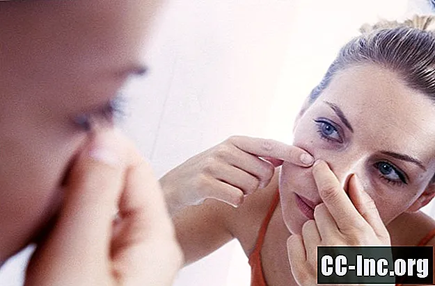 Teste de quão ruim é sua acne?