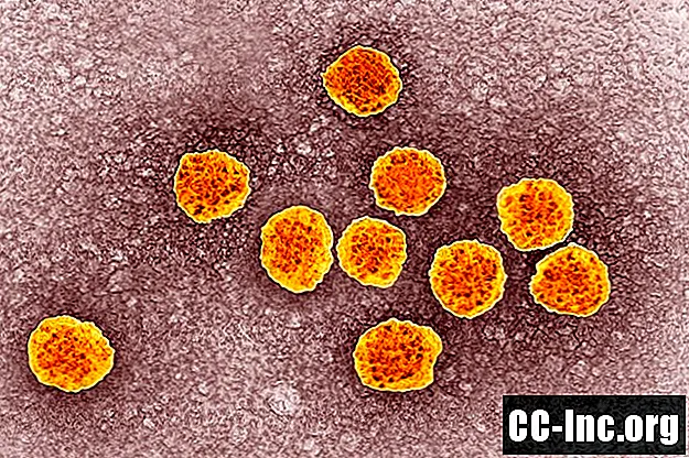Rekombináns ImmunoBlot Assay (RIBA) teszt HCV-re