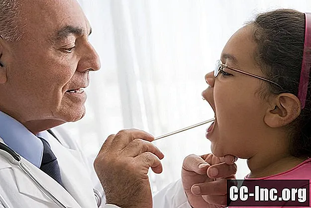 Hur Strep Throat diagnostiseras