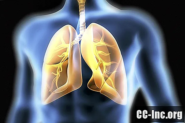 Avanços na pesquisa em fibrose pulmonar idiopática (IPF)
