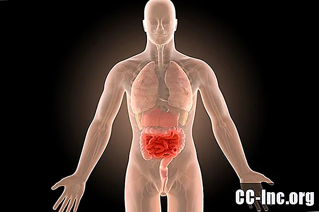 Crohn Hastalığı için Rezeksiyon Cerrahisi