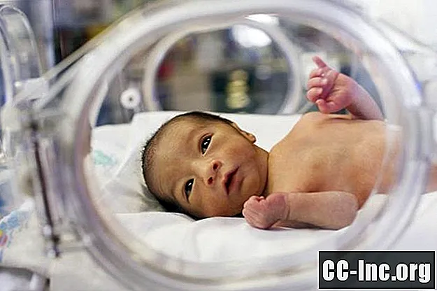 Patent Ductus Arteriosus (PDA) pada Bayi Prematur