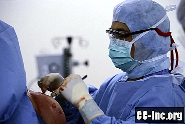 Χειρουργική επισκευής περιστροφικού μανικιού: Όλα όσα πρέπει να γνωρίζετε