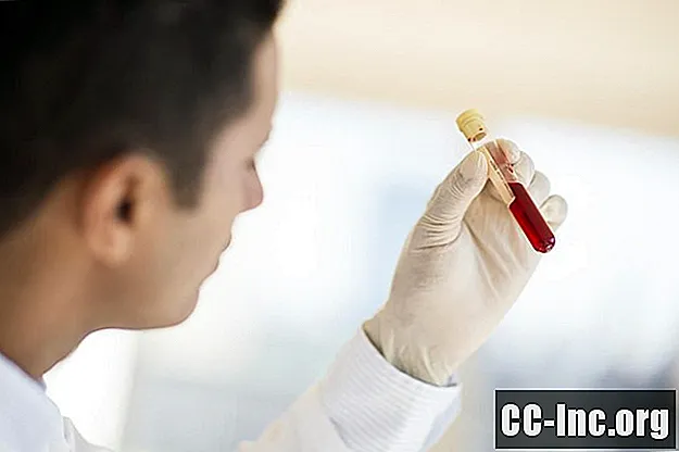 Kjønnssykdommer oppdaget ved blodprøver