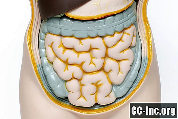 Как болестта на Crohn засяга храносмилателния тракт