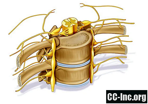 Opredelitev korenin hrbtenjačnega živca