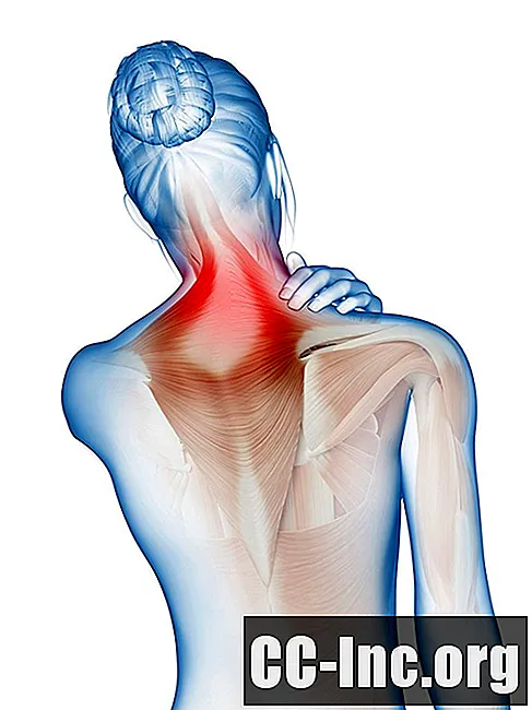 Strato superficiale dei muscoli posteriori della schiena