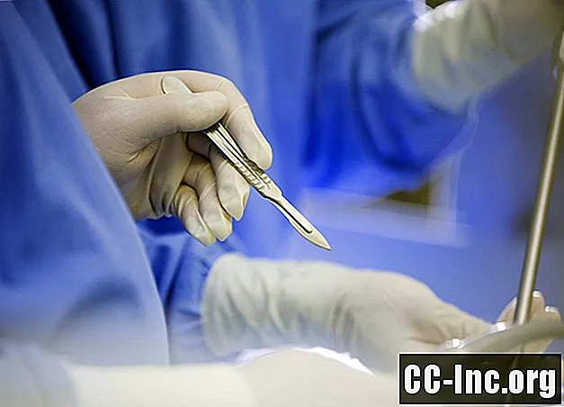 Tipi di incisione chirurgica e informazioni sulla cura